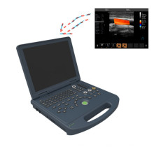 Laptop-Farbdoppler-Ultraschallscanner &amp; ecografos de China